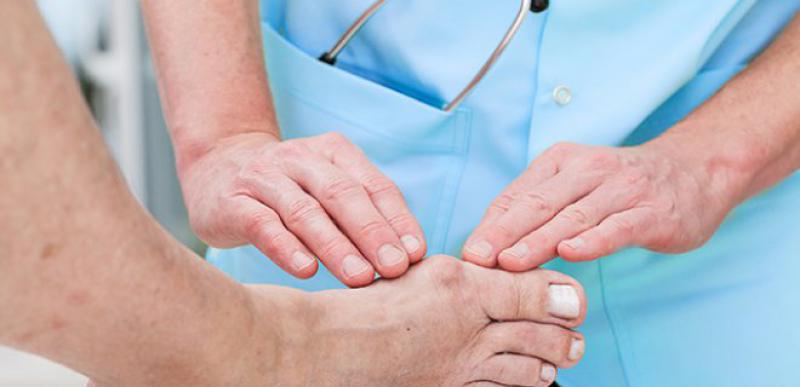 Ayakta valgus deformasyonu: prognoz ve zamanında tedavi Ayakta valgus deformasyonu: prognoz ve zamanında tedavi
